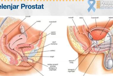 Kelenjar prostat